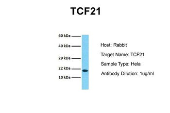 TCF21 Rabbit Polyclonal Antibody