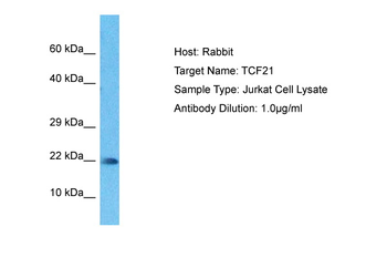 TCF21 Rabbit Polyclonal Antibody