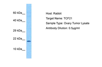 TCF21 Rabbit Polyclonal Antibody