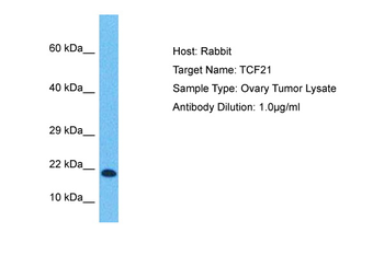 TCF21 Rabbit Polyclonal Antibody