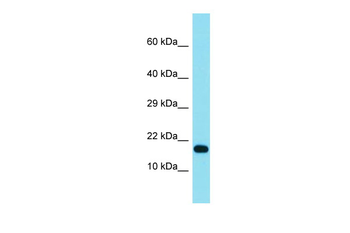 TCF21 Rabbit Polyclonal Antibody