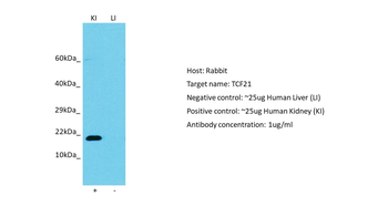 TCF21 Rabbit Polyclonal Antibody
