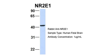 NR2E1 Rabbit Polyclonal Antibody