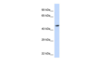 NR2E1 Rabbit Polyclonal Antibody