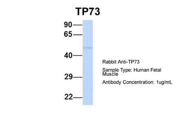 TP73 Rabbit Polyclonal Antibody