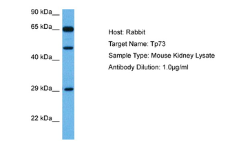 TP73 Rabbit Polyclonal Antibody