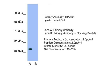 RPS16 Rabbit Polyclonal Antibody