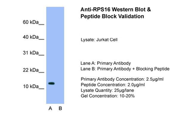 RPS16 Rabbit Polyclonal Antibody