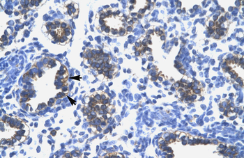 RPS16 Rabbit Polyclonal Antibody