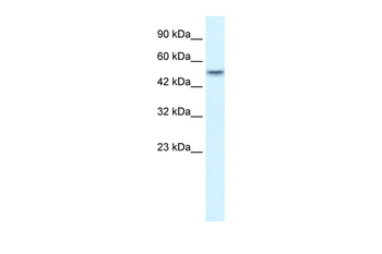 ANKRD11 Rabbit Polyclonal Antibody