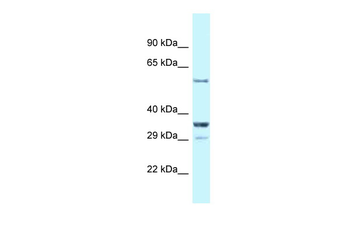 Cbll1 Rabbit Polyclonal Antibody