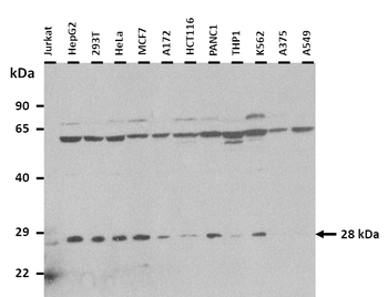 CLDN18 Rabbit Polyclonal Antibody