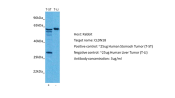CLDN18 Rabbit Polyclonal Antibody