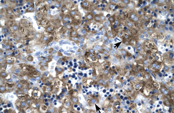 CLDN1 Rabbit Polyclonal Antibody