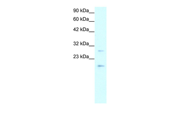 CLDN1 Rabbit Polyclonal Antibody