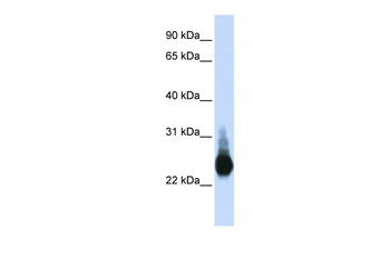CLDN5 Rabbit Polyclonal Antibody