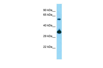 Bmi1 Rabbit Polyclonal Antibody