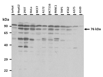NFE2L3 Rabbit Polyclonal Antibody