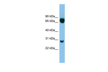 SOX13 Rabbit Polyclonal Antibody