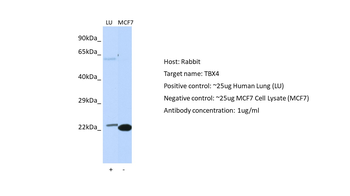 TBX4 Rabbit Polyclonal Antibody