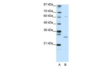 CRSP9 Rabbit Polyclonal Antibody