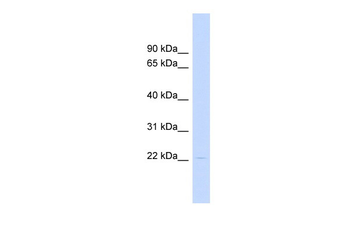 HAND1 Rabbit Polyclonal Antibody