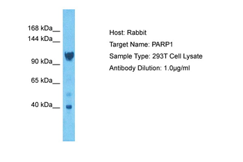 PARP11 Rabbit Polyclonal Antibody