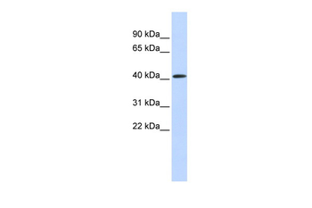 PARP11 Rabbit Polyclonal Antibody