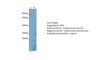 AFM Rabbit Polyclonal Antibody