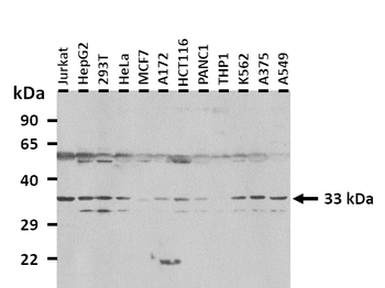 ASGR1 Rabbit Polyclonal Antibody