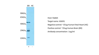 ASGR1 Rabbit Polyclonal Antibody