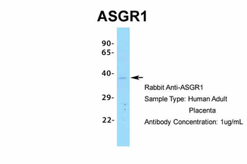 ASGR1 Rabbit Polyclonal Antibody