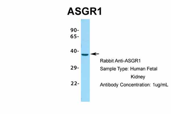 ASGR1 Rabbit Polyclonal Antibody