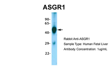 ASGR1 Rabbit Polyclonal Antibody