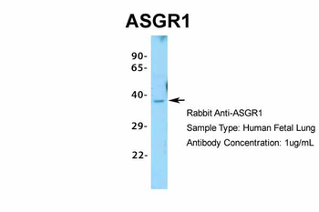 ASGR1 Rabbit Polyclonal Antibody