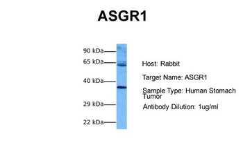 ASGR1 Rabbit Polyclonal Antibody