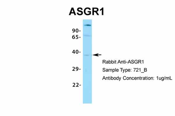 ASGR1 Rabbit Polyclonal Antibody