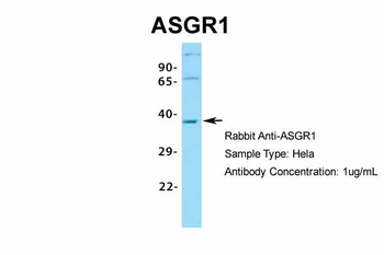ASGR1 Rabbit Polyclonal Antibody