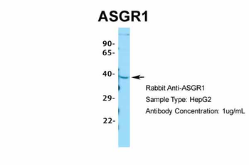 ASGR1 Rabbit Polyclonal Antibody
