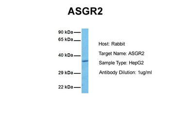 ASGR2 Rabbit Polyclonal Antibody