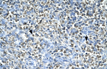 ASGR2 Rabbit Polyclonal Antibody