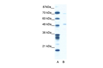 PNLIP Rabbit Polyclonal Antibody