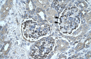 PNLIP Rabbit Polyclonal Antibody