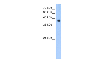 ACADL Rabbit Polyclonal Antibody
