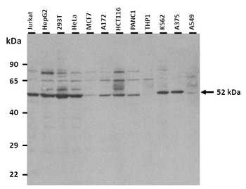 SMPDL3B Rabbit Polyclonal Antibody