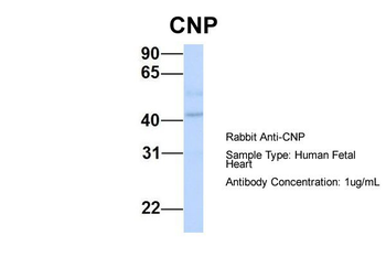 CNP Rabbit Polyclonal Antibody