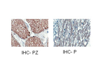 CNP Rabbit Polyclonal Antibody