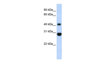 CNP Rabbit Polyclonal Antibody