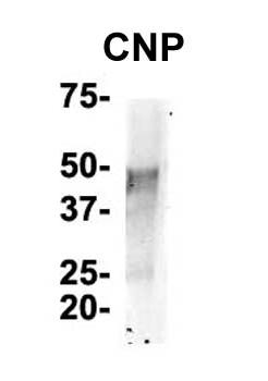 CNP Rabbit Polyclonal Antibody