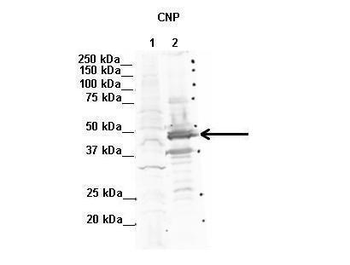 CNP Rabbit Polyclonal Antibody